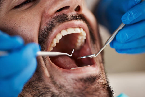 Best Emergency Treatment for Jaw Pain or Injury in Del Monte Forest, CA