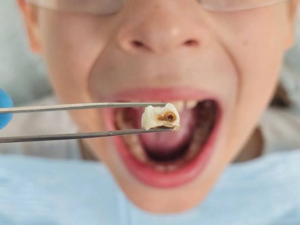 Best Emergency Denture Repair in Del Monte Forest, CA